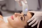 6 Reasons Why Women Go for Laser Treatment
